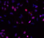 Survivin Antibody in Immunocytochemistry (ICC/IF)