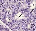 Survivin Antibody in Immunohistochemistry (Paraffin) (IHC (P))