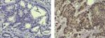 Estrogen Receptor beta Antibody in Immunohistochemistry (Paraffin) (IHC (P))