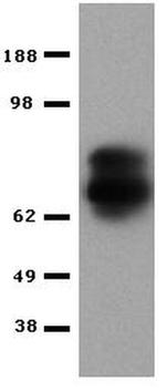 Perforin Antibody in Western Blot (WB)