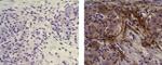 CD271 (NGF Receptor) Antibody in Immunohistochemistry (Paraffin) (IHC (P))