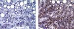 alpha-Fetoprotein Antibody in Immunohistochemistry (Paraffin) (IHC (P))