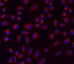 PAR2 Antibody in Immunocytochemistry (ICC/IF)