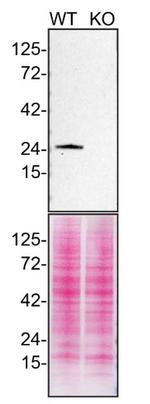 RAB5A Antibody in Western Blot (WB)