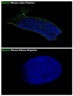 Desmin Antibody in Immunohistochemistry (Paraffin) (IHC (P))