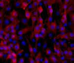 Desmin Antibody in Immunocytochemistry (ICC/IF)