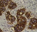 ErbB2 (HER-2) Antibody in Immunohistochemistry (Paraffin) (IHC (P))