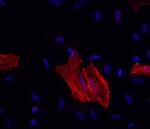 Alpha-Smooth Muscle Actin Antibody in Immunocytochemistry (ICC/IF)