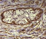 Alpha-Smooth Muscle Actin Antibody in Immunohistochemistry (Paraffin) (IHC (P))