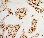 Progesterone Receptor Antibody in Immunohistochemistry (Paraffin) (IHC (P))