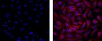 Dynein Antibody in Immunocytochemistry (ICC/IF)