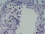 SOX2 Antibody in Immunohistochemistry (Paraffin) (IHC (P))