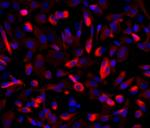 Nestin Antibody in Immunocytochemistry (ICC/IF)