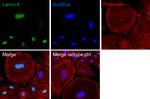 Lamin A Antibody in Immunocytochemistry (ICC/IF)