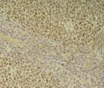 BCL6 Antibody in Immunohistochemistry (Paraffin) (IHC (P))