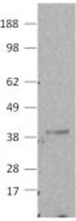 Caspase 7 Antibody in Western Blot (WB)