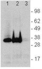 LAT Antibody in Western Blot (WB)