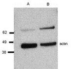 Perforin Antibody in Western Blot (WB)