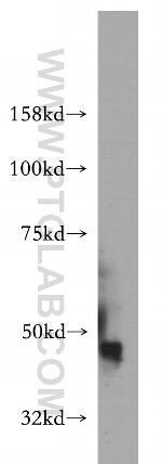 IGSF11 Antibody in Western Blot (WB)