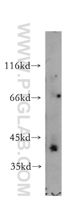 IGSF11 Antibody in Western Blot (WB)