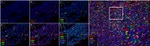 FOXP3 Antibody in Immunohistochemistry (Paraffin) (IHC (P))