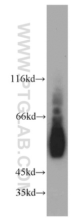 ESR2 Antibody in Western Blot (WB)