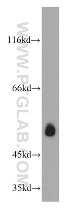 ESR2 Antibody in Western Blot (WB)