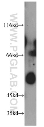 ESR2 Antibody in Western Blot (WB)