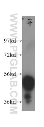 ESR2 Antibody in Western Blot (WB)