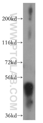 ESR2 Antibody in Western Blot (WB)