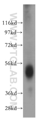 ESR2 Antibody in Western Blot (WB)