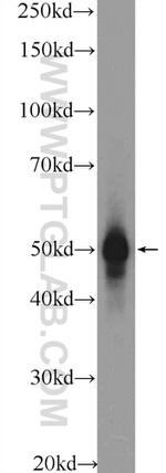 ESR2 Antibody in Western Blot (WB)