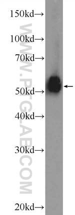 ESR2 Antibody in Western Blot (WB)