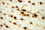 ELAVL2 Antibody in Immunohistochemistry (Paraffin) (IHC (P))