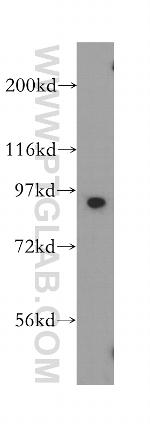 SOX6 Antibody in Western Blot (WB)