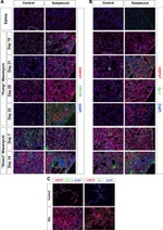 Ly-6G/Ly-6C Antibody in Immunohistochemistry (IHC)