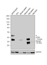 CD20 Antibody in Western Blot (WB)