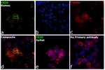 CD20 Antibody