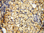 AADACL1 Antibody in Immunohistochemistry (Paraffin) (IHC (P))