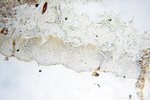 AADACL1 Antibody in Immunohistochemistry (Paraffin) (IHC (P))