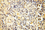 AADACL1 Antibody in Immunohistochemistry (Paraffin) (IHC (P))