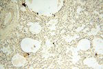 AADACL1 Antibody in Immunohistochemistry (Paraffin) (IHC (P))