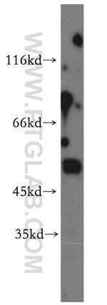 AADACL1 Antibody in Western Blot (WB)