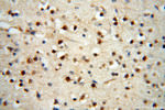 AADACL1 Antibody in Immunohistochemistry (Paraffin) (IHC (P))