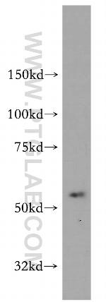 AADACL1 Antibody in Western Blot (WB)