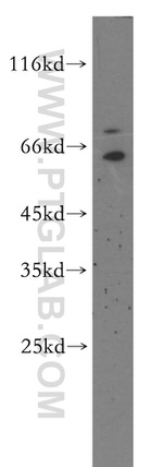 SYNCRIP Antibody in Western Blot (WB)