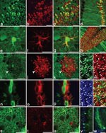 CD24 Antibody in Immunohistochemistry (IHC)