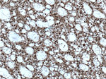 ZEB2 Antibody in Immunohistochemistry (Paraffin) (IHC (P))