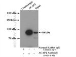 ACAP2 Antibody in Immunoprecipitation (IP)