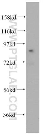 ACAP2 Antibody in Western Blot (WB)